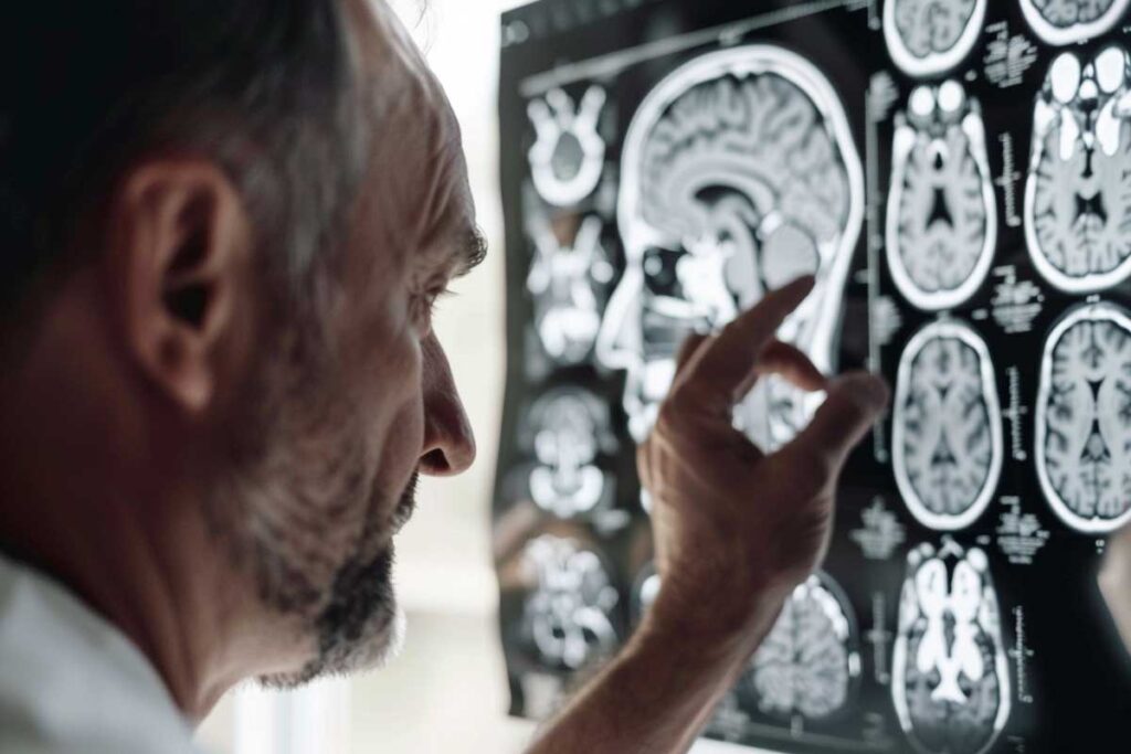Doctors Are Sharing 6 Daily Habits That Age Your Brain Faster