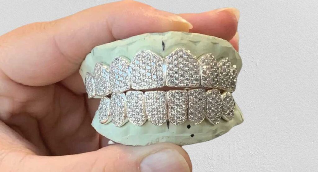 What Should You Look for in a Quality Diamond Grillz?