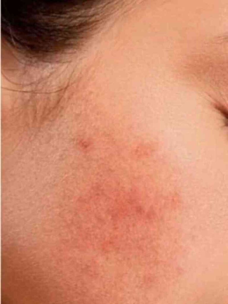 How Mineral and Chemical Sunscreens Work